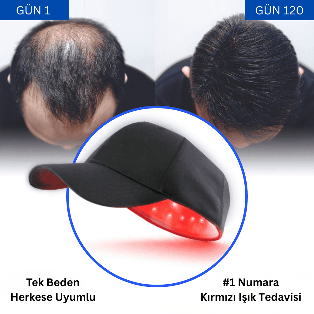 LazerCap Saç Terapi Şapkası